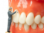 QUY TRÌNH LẤY CAO RĂNG CÓ PHỨC TẠP KHÔNG?