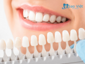 Hiểu Thế Nào Về Phương Pháp Nha Khoa Bọc Răng Sứ
