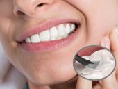 CÓ NÊN TRÁM RĂNG HAY KHÔNG? 